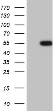LHX2 Antibody (aa220-406, clone OTI5D1, Carrier-free)