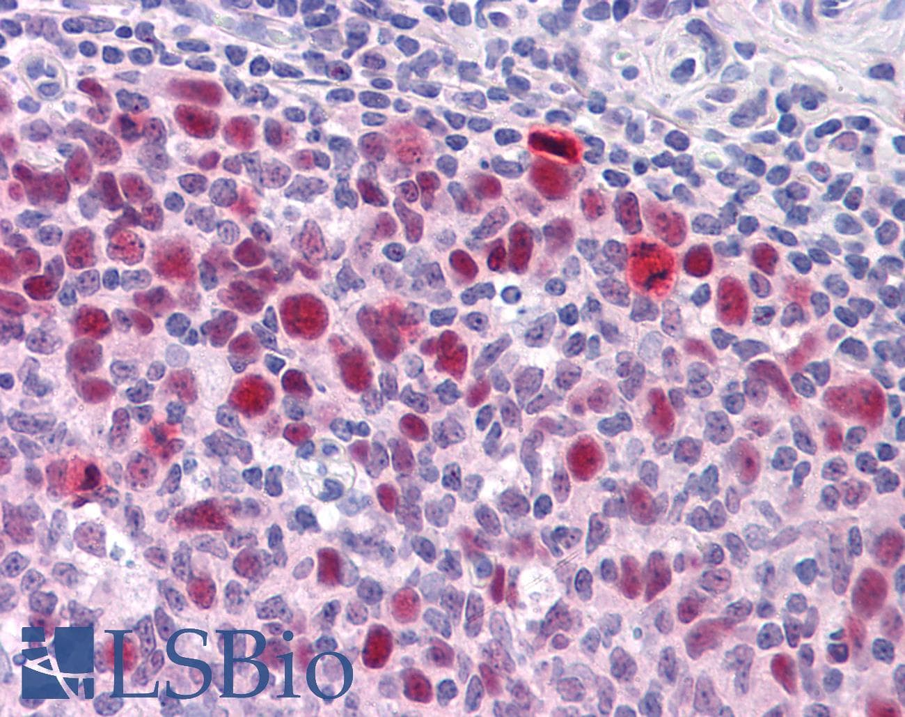 IHC-plus™ SOX9 Antibody (clone 3C10)