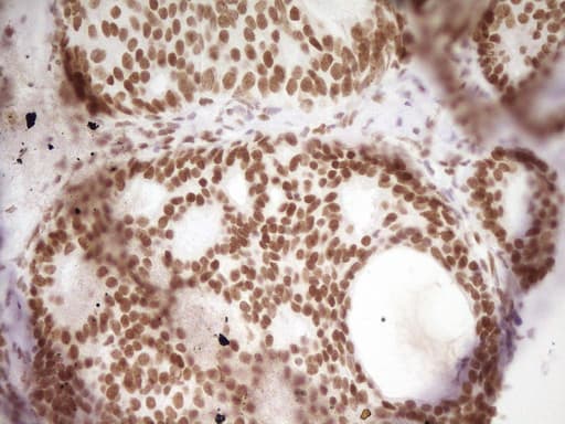 HMG20A Antibody (aa1-281, clone OTI2H4)