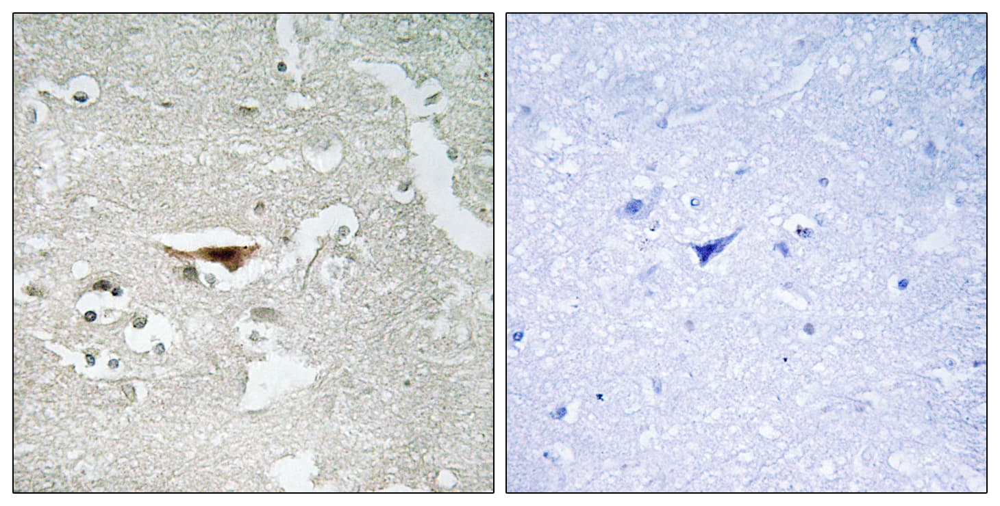 PKIB Antibody (aa29-78)