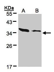 Polyclonal Rabbit anti-Human ARPC2 / p34-Arc Antibody (aa14-300, IHC, WB)