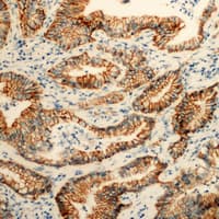 PEX11B Antibody (Internal)