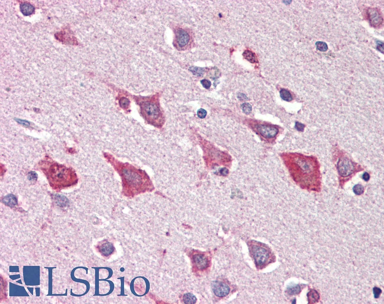 IHC-plus™ MOB4 / PHOCN Antibody (aa116-130)