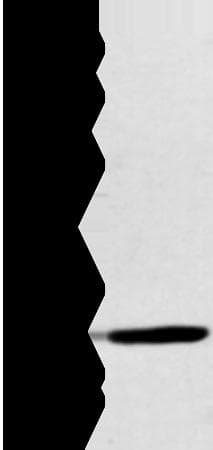 CALB2 / Calretinin Antibody