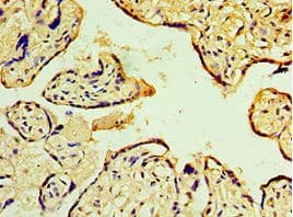 Polyclonal Rabbit anti-Human MAP2K3 / MEK3 / MKK3 Antibody (aa1-170, IHC)