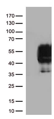 PDCD1 / CD279 / PD-1 Antibody (clone UMAB197)
