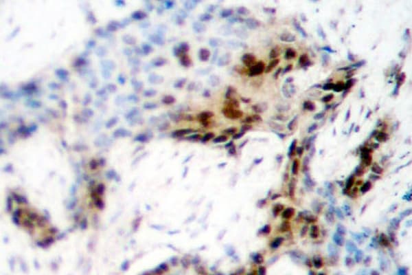 ER Alpha / Estrogen Receptor Antibody (His112)