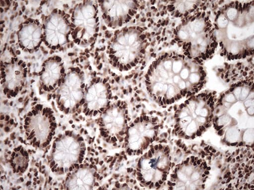TRIM28 / KAP1 Antibody (clone OTI8B12, Carrier-free)