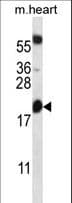 BCL2 / Bcl-2 Antibody (aa86-114)