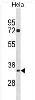 Polyclonal Rabbit anti-Human TIPIN Antibody (aa227-254, WB)