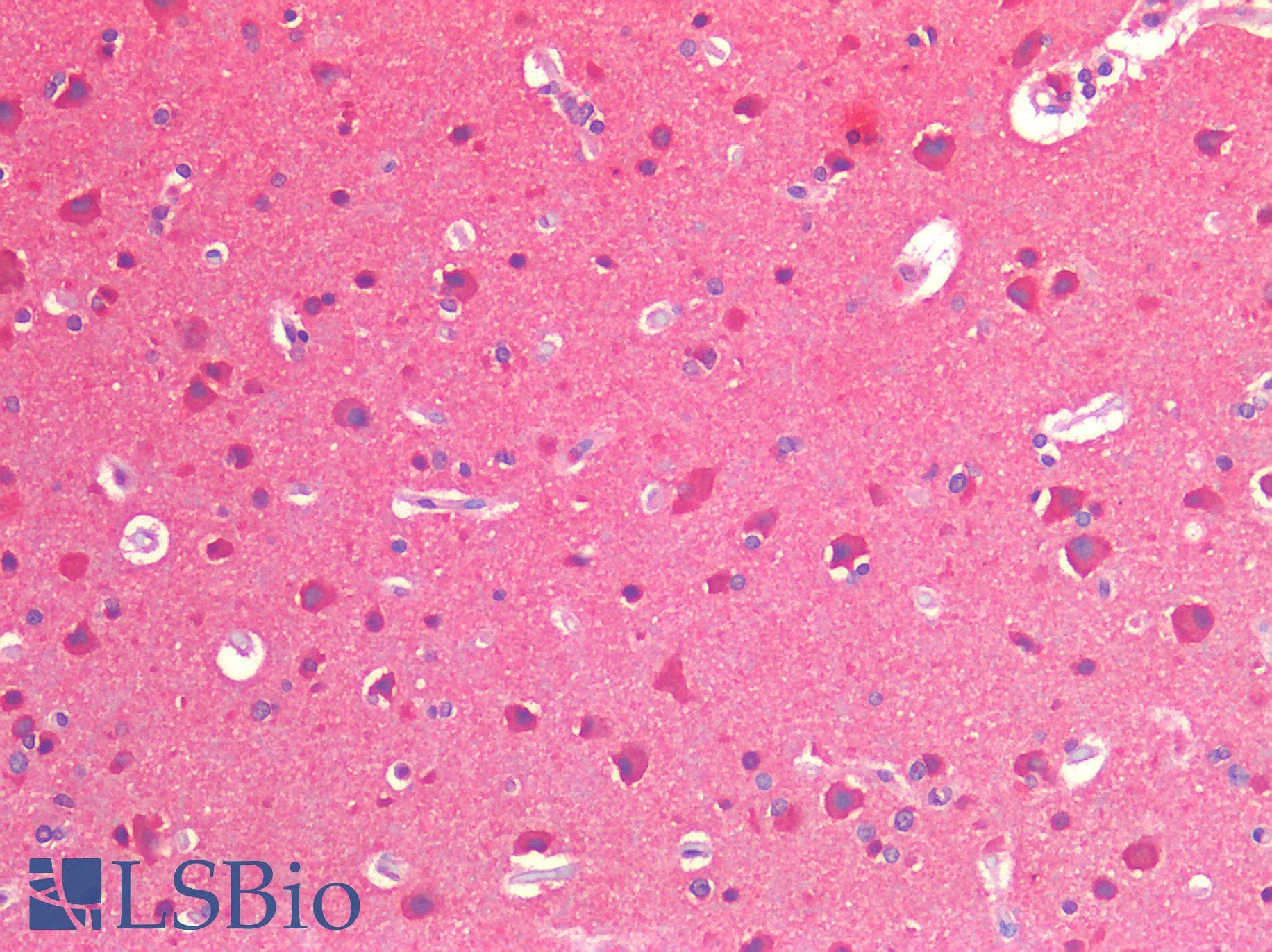 IHC-plus™ Polyclonal Rabbit anti-Human IGF1R / IGF1 Receptor Antibody (IHC)