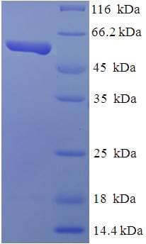 Human TEAD4 Protein (Recombinant His-SUMO)