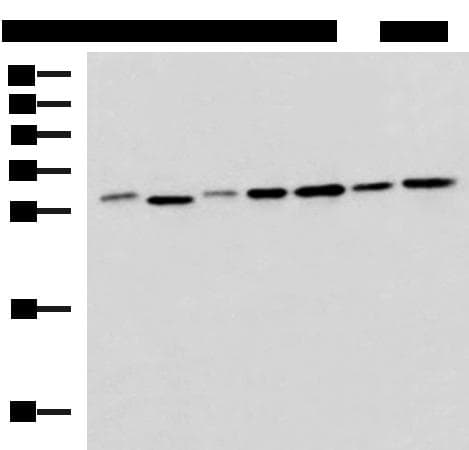 EXOSC4 / RRP41 Antibody