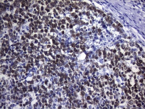 POU2AF1 / BOB1 Antibody (clone UMAB220, Carrier-free)