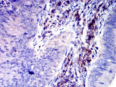 SLAMF6 / NTBA Antibody (clone 2F1C9)