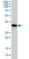 TS / Thymidylate Synthase Antibody (clone 3A1)