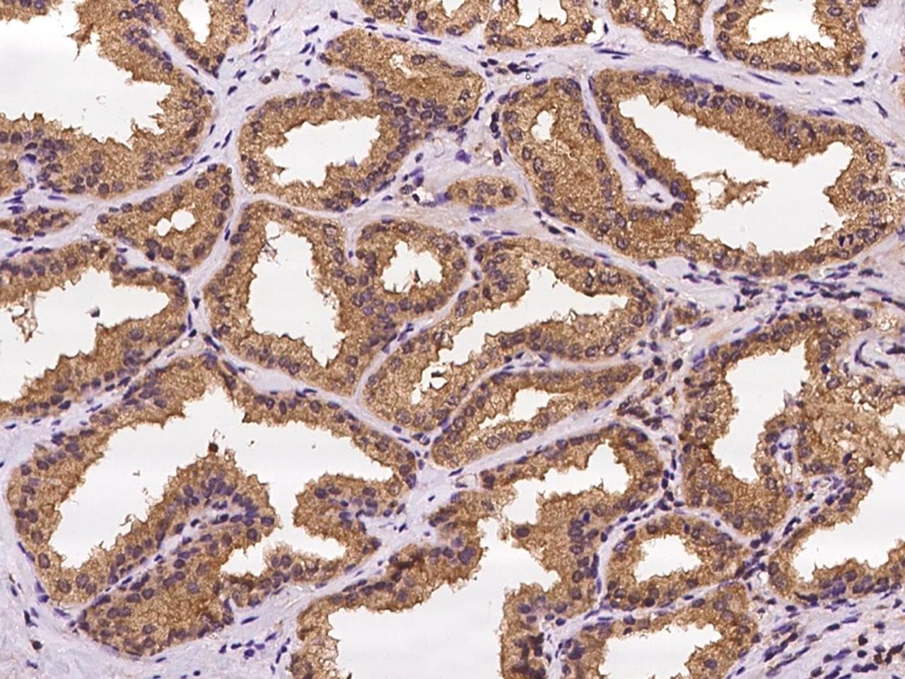 SFT2D2 Antibody
