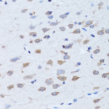 ARH / LDLRAP1 Antibody