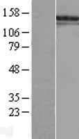 TBS / SALL1 Protein (Over-Expression Lysate Myc-DDK (Flag))