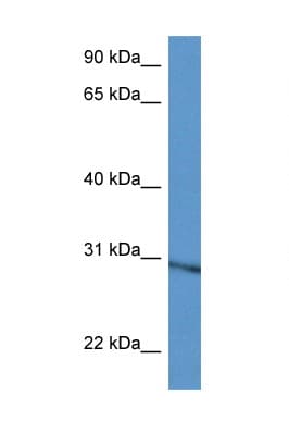Polyclonal Rabbit anti-Mouse RPL5 / Ribosomal Protein L5 Antibody (aa152-201, WB)