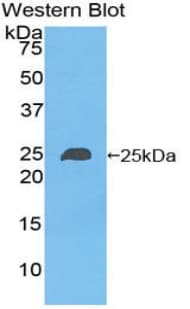 NME6 Antibody (aa3-182)