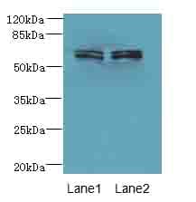 ZNF215 Antibody