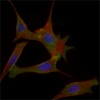 IHC-plus™ I-FABP / FABP2 Antibody (clone 9A9B7B3)