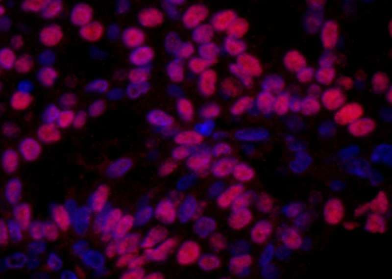 Polyclonal Rabbit anti-Human HMGN1 / HMG14 Antibody (aa90-100, IHC, IF)