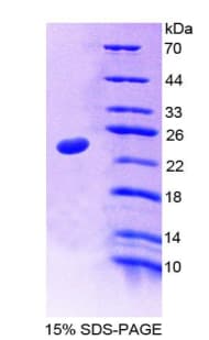 Human NUP35 / NUP53 Protein (Recombinant His-T7)