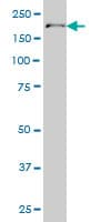 POLA1 / DNA Polymerase Alpha 1 Antibody (clone 3C11)