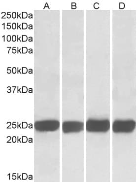 IHC-plus™ GRB2 Antibody (aa206-217)