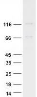 Human EVC / DWF-1 Protein (Recombinant Myc-DDK (Flag))