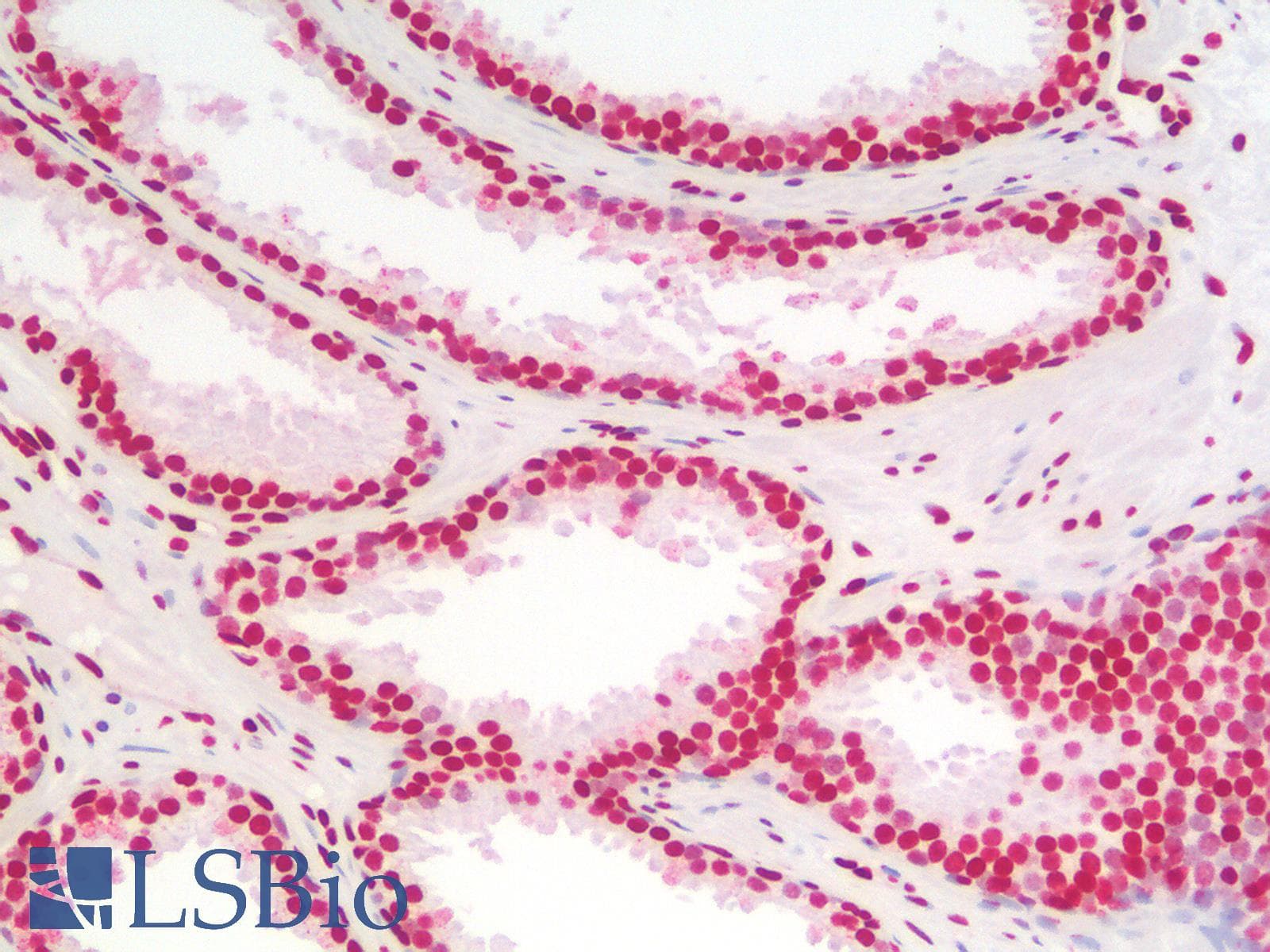 IHC-plus™ Polyclonal Rabbit anti-Mouse HMG1 / HMGB1 Antibody (IHC, IF, WB)