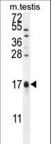 CAMK2N1 Antibody (aa37-65)