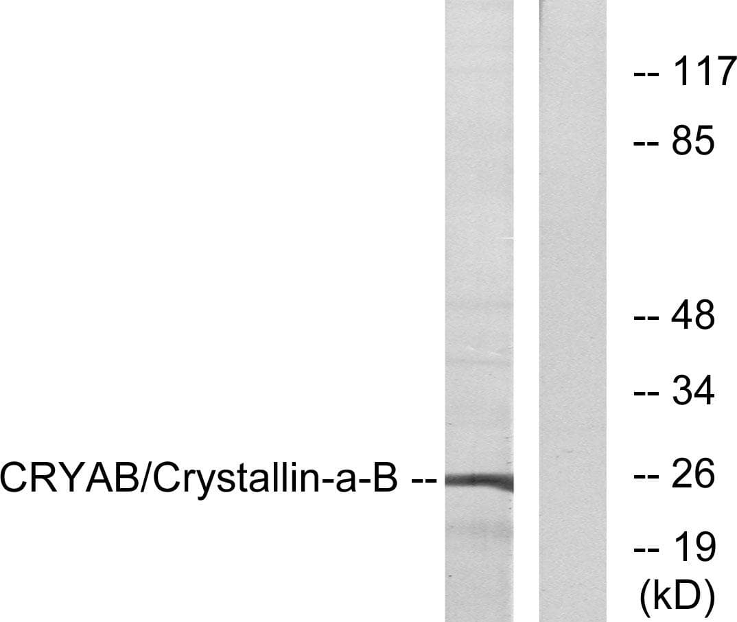 CRYAB / Alpha B Crystallin Antibody (p19)