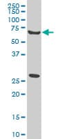 WASF2 / SCAR2 Antibody (clone 1F7)