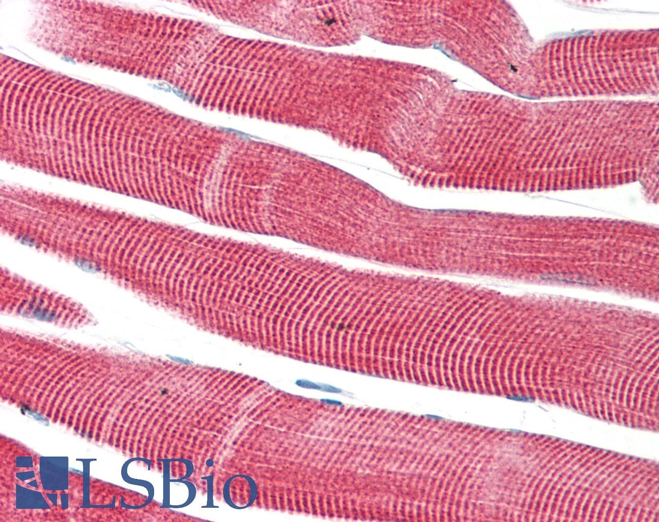 PathPlus™ Monoclonal Mouse anti-Human Muscle Actin Antibody (IHC)