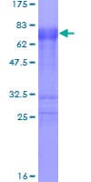 Human ZFP36 / Tristetraprolin Protein (Recombinant GST)