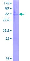Human ECHDC2 Protein (Recombinant GST)