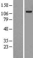 USP38 Protein (Over-Expression Lysate Myc-DDK (Flag))