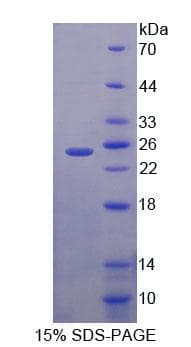 Human XPO5 / Exportin 5 Protein (Recombinant His-T7, N-terminus)