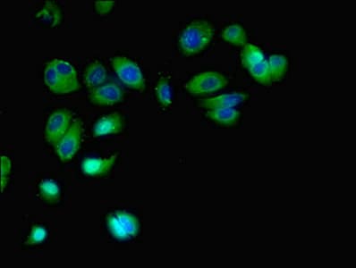 Polyclonal Rabbit anti-Human FFAR2 / GPR43 Antibody