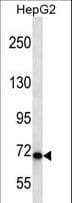 CHD1L Antibody (aa561-590)