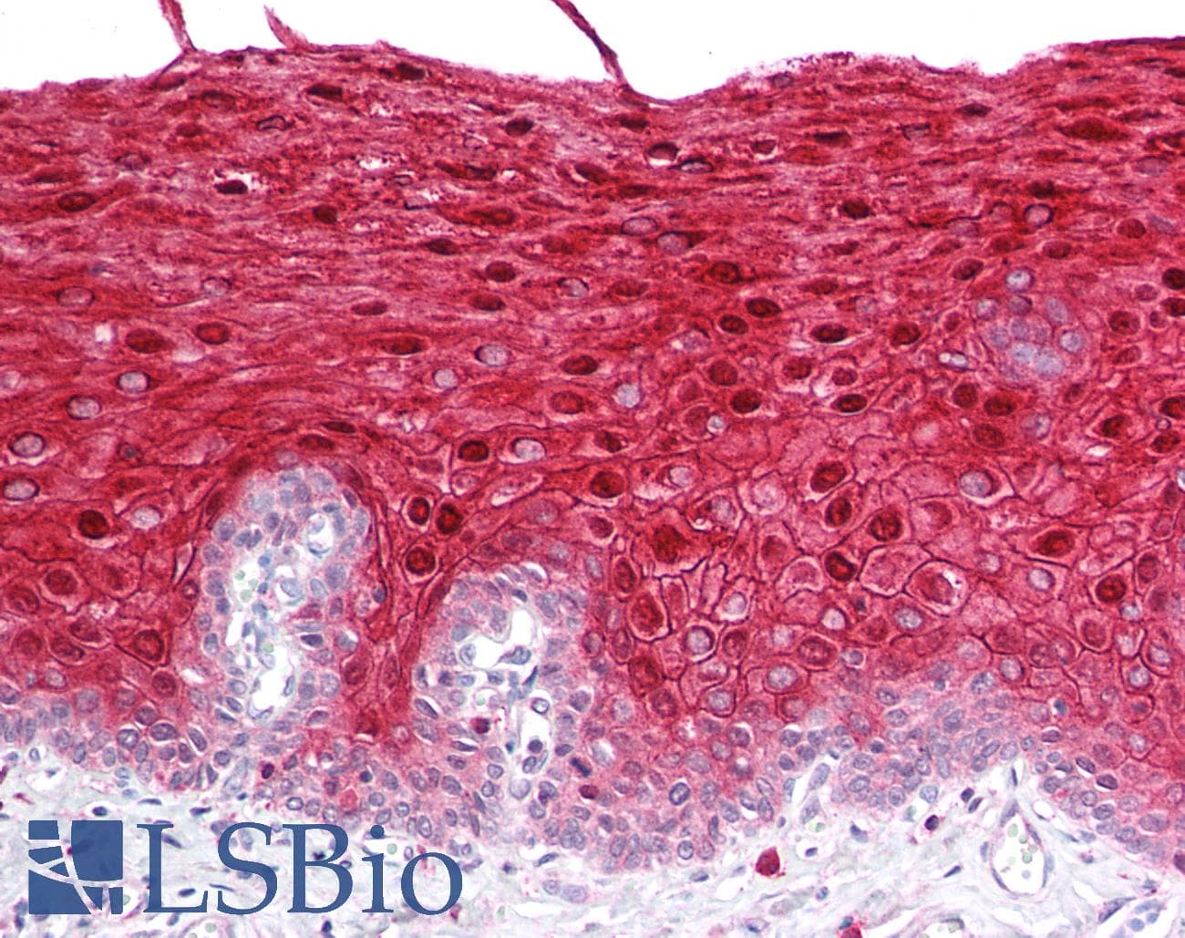 PathPlus™ ANXA1 / Annexin A1 Antibody
