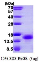 Human PKIB Protein (Recombinant His)