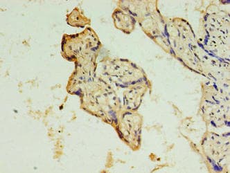 DRC7 / CCDC135 Antibody