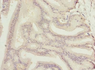 NOL6 / NRAP Antibody