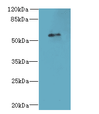 Polyclonal Rabbit anti-Human GPR176 Antibody (WB)