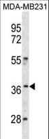 Polyclonal Rabbit anti-Human HOXC10 Antibody (aa224-250, IF, WB)