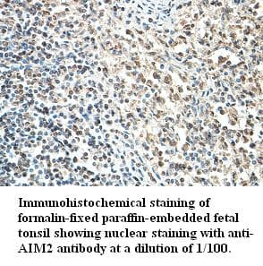 Polyclonal Rabbit anti-Human AIM2 Antibody (IHC, WB)